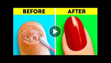 Amazing Nail Transformation || Girly Beauty Tricks